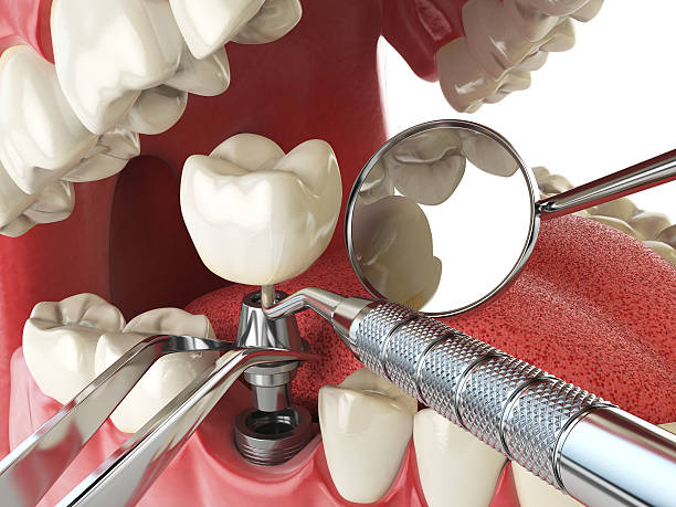 Best Emergency Orthodontic Repairs in Pearisburg, VA